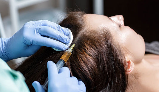 Comparing PRP and Mesotherapy for Effective Hair Loss Treatments
