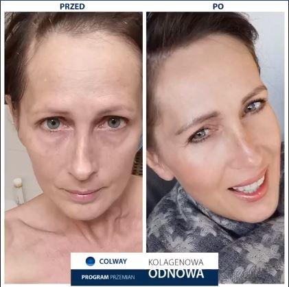 Spectrum ampoules (2 + 7) | face lift without surgery | Results in 7 days Spectrum ampoules (2 + 7) | face lift without surgery | Results in 7 days