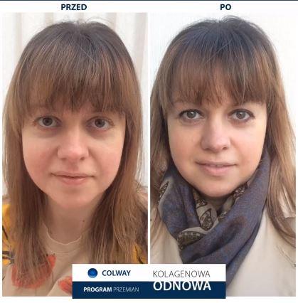 Spectrum ampoules (2 + 7) | face lift without surgery | Results in 7 days Spectrum ampoules (2 + 7) | face lift without surgery | Results in 7 days