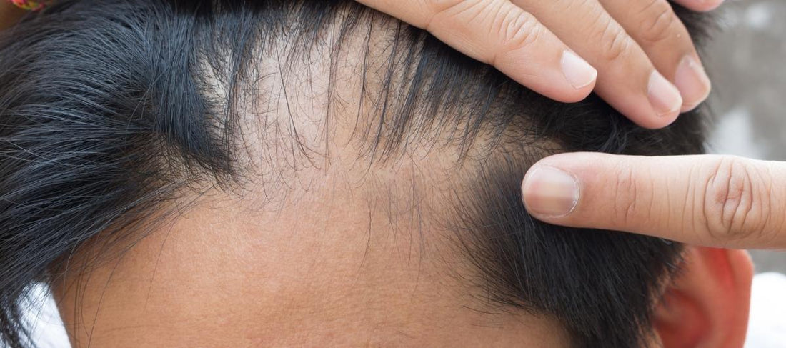 Kamree Hair Growth Scalp Serum | With Procapil,Redensyl, PISUM SATIVUM For  Reduce hairfall,Promote Hair growth For Men & Women | 40 ml in Beauty  Products | zaimboo by Sanskriti Bazaar Reaching up